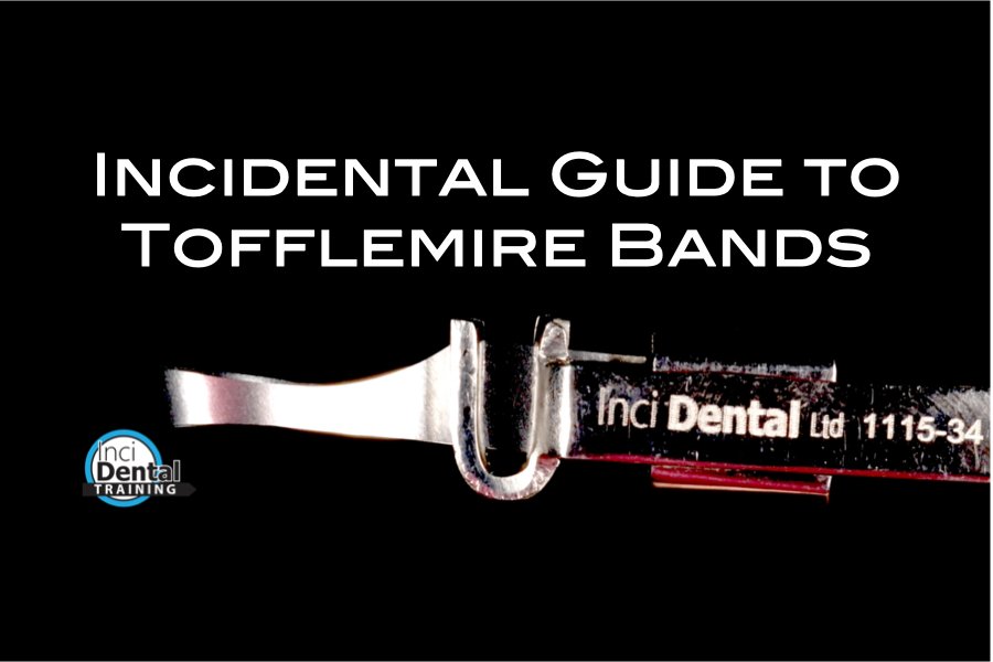 Guide to Tofflemire Bands and Retainers with demo video - Incidental