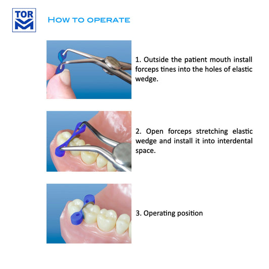 Elastic Wedges (40 pcs) - Incidental