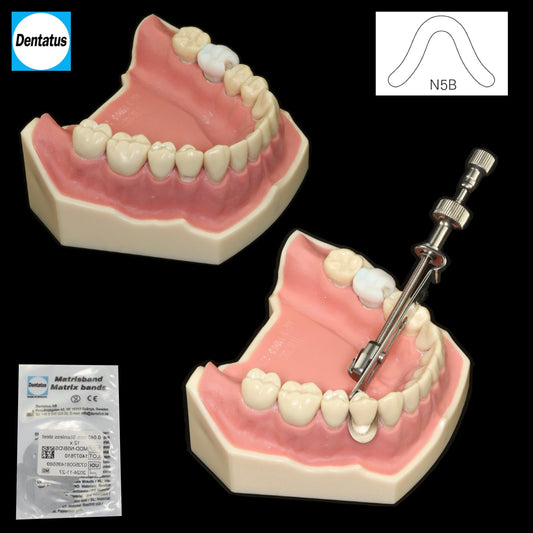 N5B Class 5 Matrix Band - Incidental