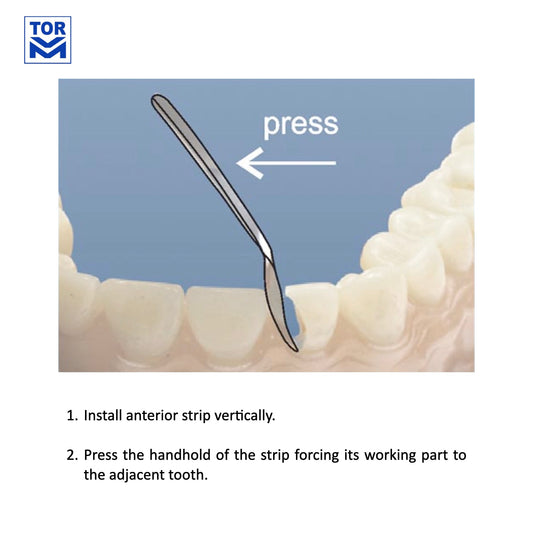 Proximal Anterior Strips (12 pcs) - Incidental