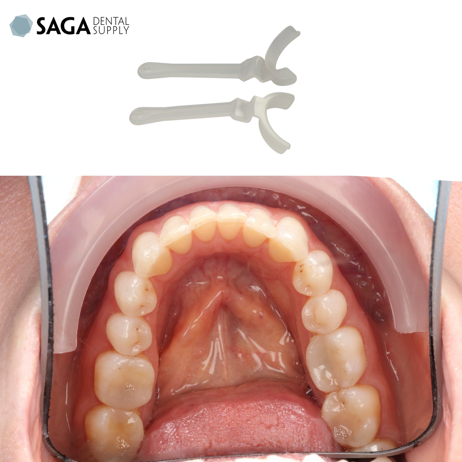 K&K Occlusal Retractor - Incidental