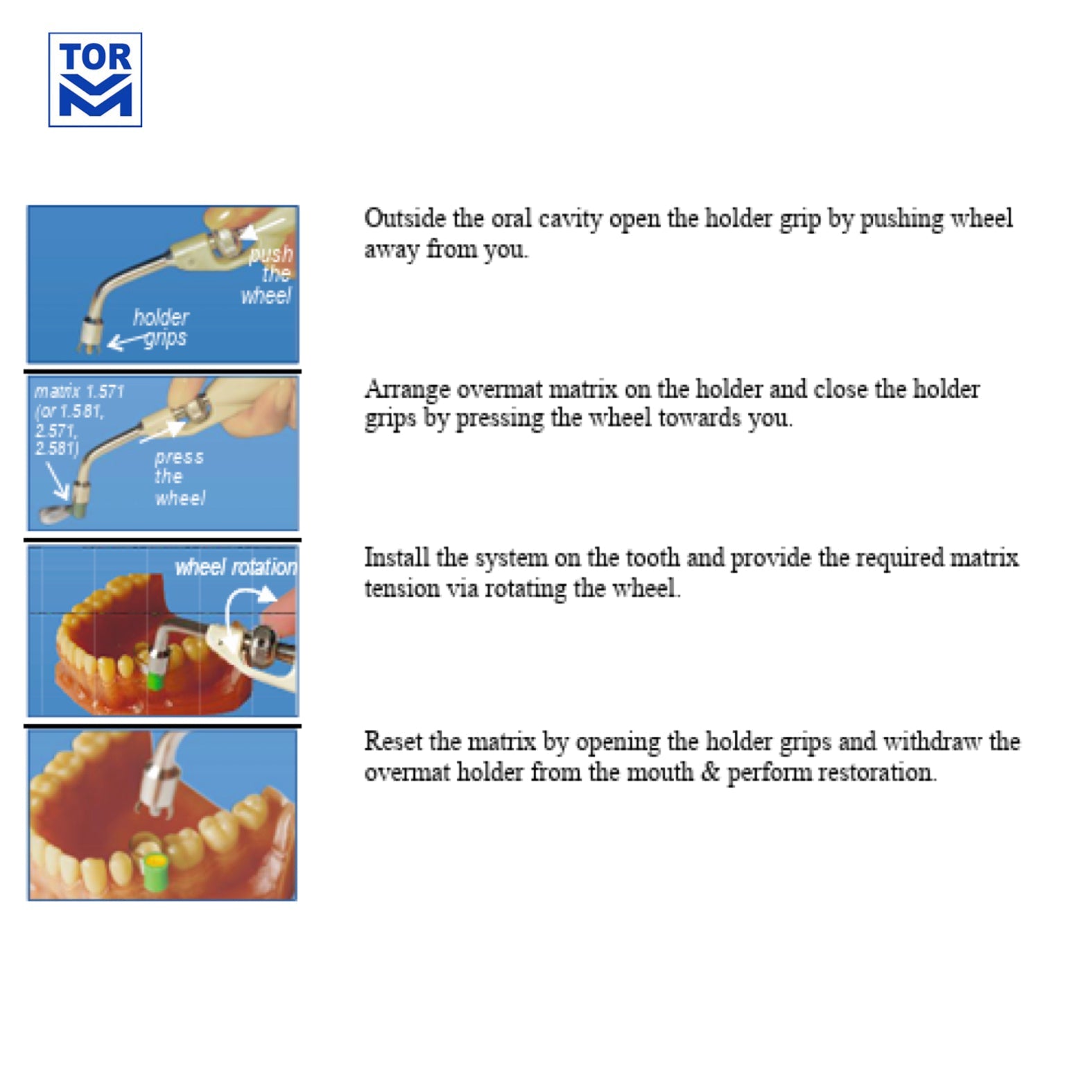 Overmat Matrix Bands - 40 pieces - Incidental