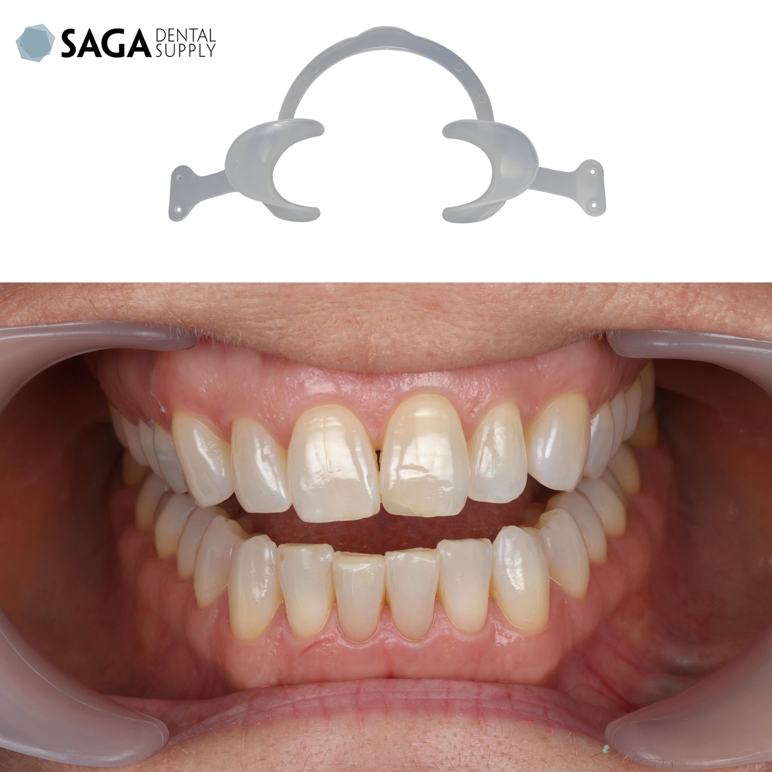 Scandee - Spring retractors with extendable tabs (2pcs) - Incidental